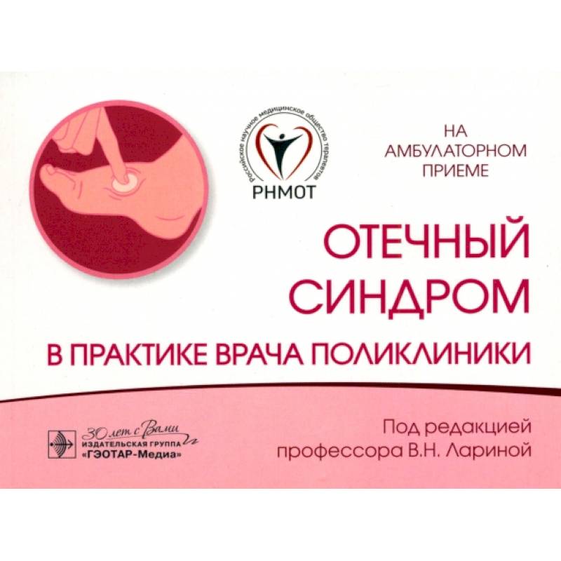 Отечный синдром в практике врача поликлиники