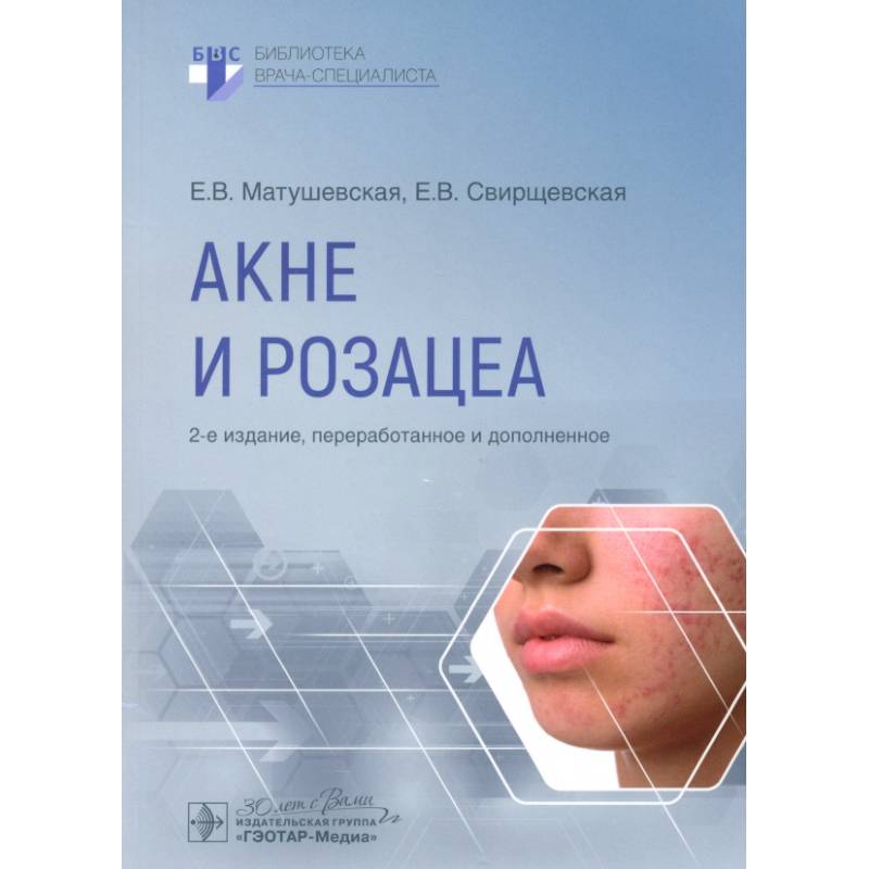 Акне и розацеа