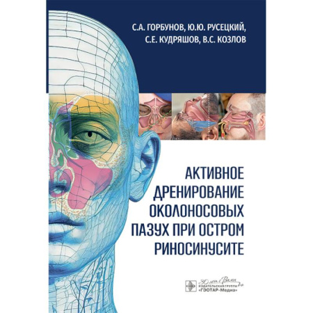 Медицинские энциклопедии и справочники, книга Активное дренирование околоносовых пазух при остром риносинусите купить по скидке