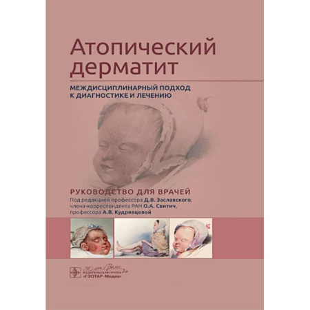 Кожные и венерические болезни, книга Атопический дерматит. Междисциплинарный подход к диагностике и лечению: руководство для врачей купить по скидке