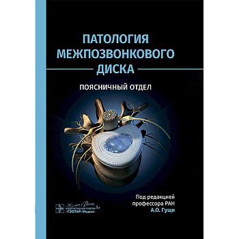 Патология межпозвонкового диска. Поясничный отдел