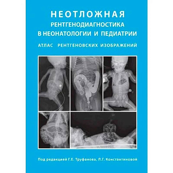 Неотложная рентгенодиагностика в неонатологии и педиатрии