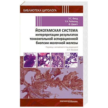 Медицинские энциклопедии и справочники, книга Йокогамская система интерпретации результатов тонкоигольной аспирационной биопсии молочной железы купить по скидке