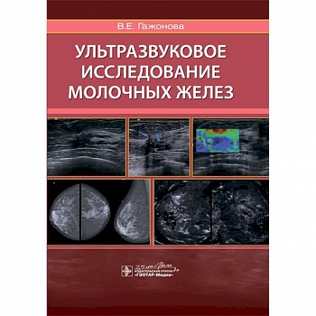 Ультразвуковое исследование молочных желез