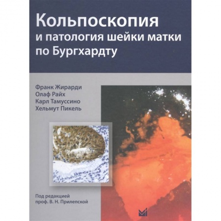 Другие виды специальной медицины, книга Кольпоскопия и патология шейки матки по Бургхардту купить по скидке