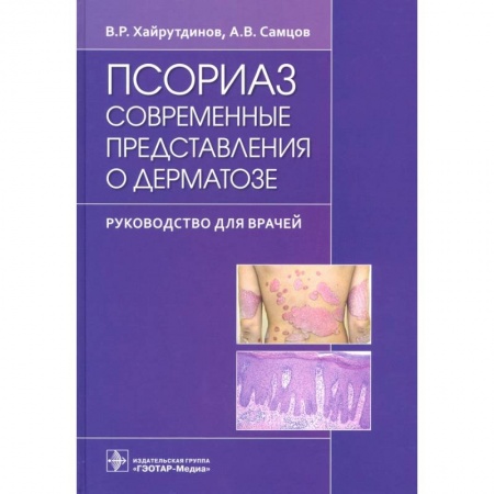 Кожные и венерические болезни, книга Псориаз. Современные представления о дерматозе. Руководство для врачей купить по скидке