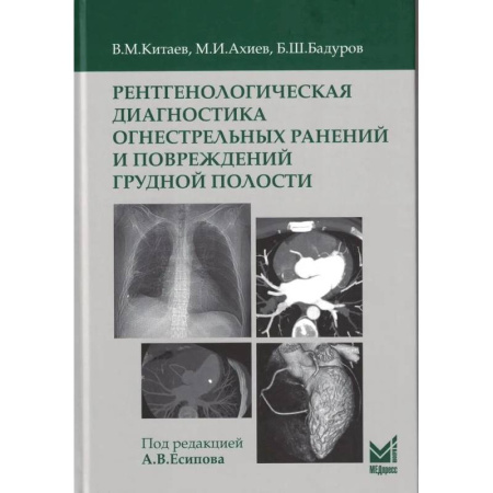 УЗИ. ЭКГ. Томография. Рентген, книга Рентгенологическая диагностика огнестрельных ранений и повреждений грудной полости купить по скидке