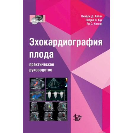 Медицинские энциклопедии и справочники, книга Эхокардиография плода: практическое руководство. + DVD купить по скидке