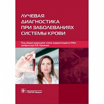 Лучевая диагностика при заболеваниях системы крови
