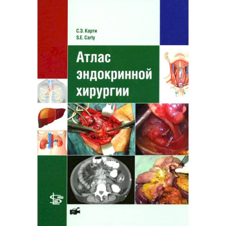 Эндокринология, книга Атлас эндокринной хирургии купить по скидке
