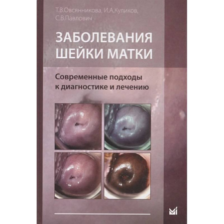 Онкология, книга Заболевания шейки матки. Современные подходы к диагностике и лечению купить по скидке