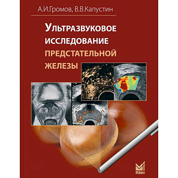 Ультразвуковое исследование предстательной железы